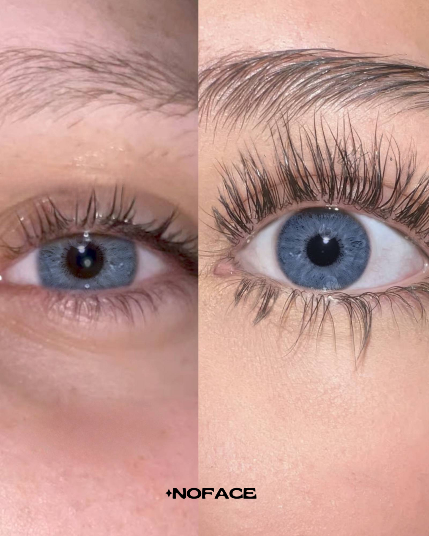 NOFACE™ LASH SERUM